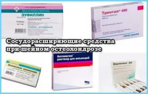 Лекарства при шейном остеохондрозе