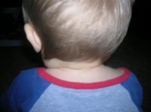 Лимфоузлы на шее у ребёнка