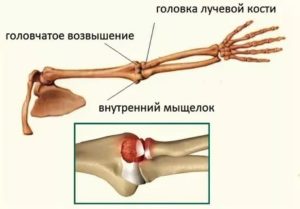 Головка Локтевой Кости Фото