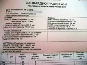 Рекомендации по результатам эхокардиограммы сердца