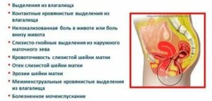 После родов ноющая боль внизу живота, после секса.