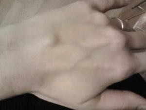 Вздулась вена на запястье