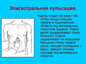 Пульс в районе пупка и выше