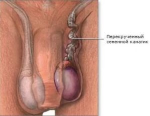 Проблема с коже мошонки