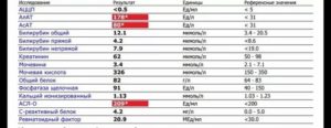 Расшифровка анализа на ревматоидный фактор
