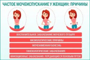 Частое мочеиспускание без боли