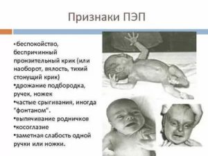 Диагноз ПЭП у новорожденного