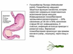 Хеликобактер, боль после лечения