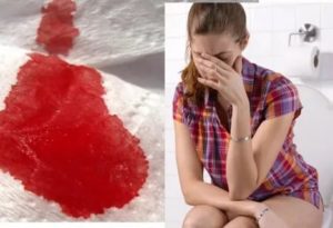 Боль и кровь после акта дефекации после родов