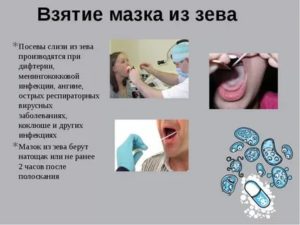 Посев из зева