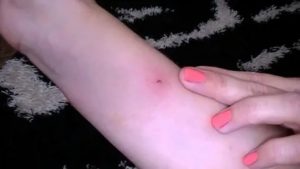 Поцарапал кот возможно бешенство?