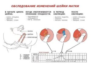 Является ли нормой сомкнутость цервикального канала во время месячных?