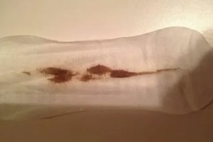 Коричневые выделения на 30 неделе