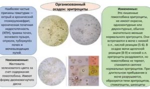 Эритроциты в моче Ca25 Ery / ul