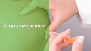 После 2уколов бусерелин депо все равно идут месячные