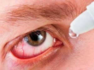 Послеоперационное воспаление глаза