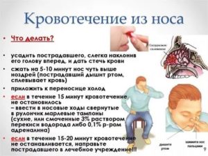 Кровь из носа при приеме Курантила