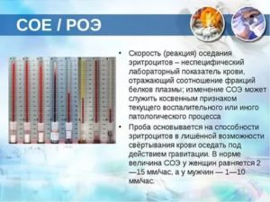 Высокое СОЭ и температура после операции