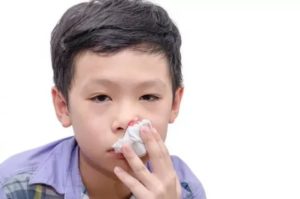 Частые кровотечения из носа у ребенка