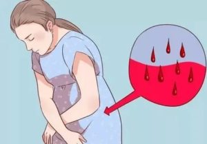 Кровотечение у бабушки