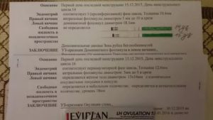 Узи 20 день цикла желтое тело