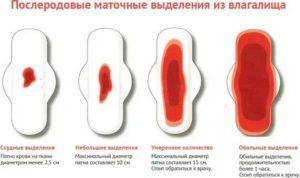 Коричневые выделения после лишения девственности