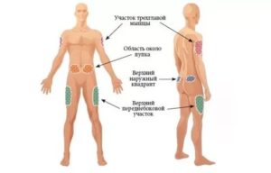 Можно ли колоть Генфаксон 2р?