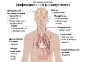 После перенесенного мононуклеоза в течении 9 месяцев не проходят лимфоузлы