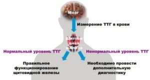 Узел в щетовидной железе и низкий ттг