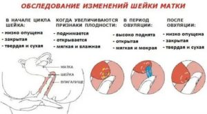 Мягкая шейка матки через неделю после месячных