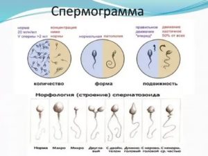 Плохая спермограмма, чем лечить чтобы произошло зачатие