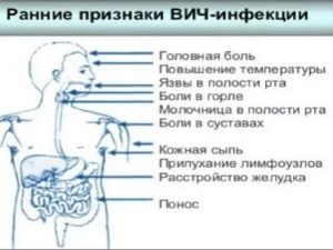 Боюсь, что у меня симптомы вич