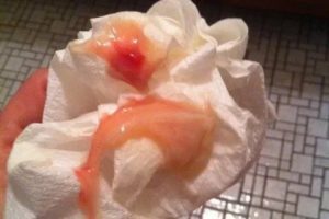 Кровянистые и мажущие выделения после удаления миомы