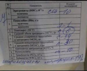 Мононуклеоз и анализ крови