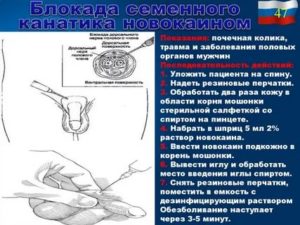 После блокады семенного канатика