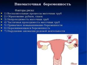 Как избежать повторной внематочной беременности?