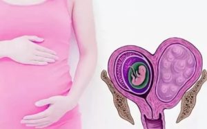 Признаки беременности при миоме