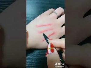 Порезы на руках подростка при медосмотре. Что делать?