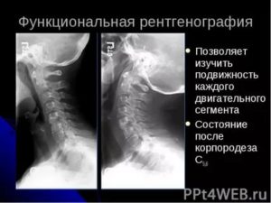 Функциональный блок на рентгенограмме