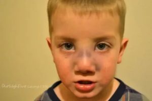 Ушиб носа у ребенка 2.5 лет