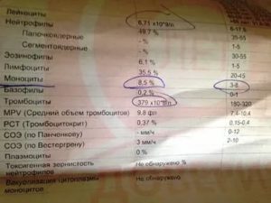 Понижены моноциты