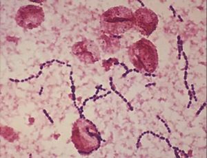 Посев из эякулята streptococcus mitis и streptococcus mitis