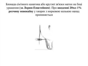 После блокады семенного канатика