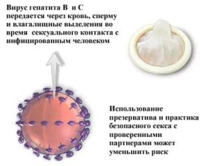 Презерватив защищает от гепатита б
