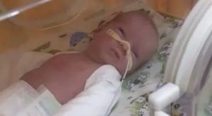 Кесарево 30 недель беременности