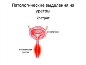 Кровь из уретры после полового акта