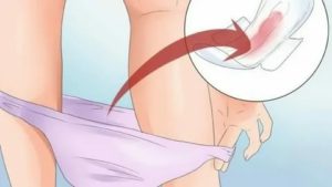 Кровянистые выделения после спринцевания