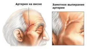 Болит голова, вздулась вена на голове, головокружение