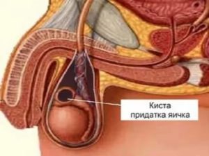 Немеет левое яичко