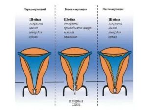 Является ли нормой сомкнутость цервикального канала во время месячных?